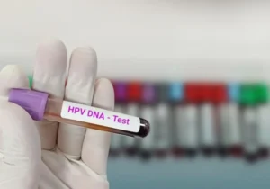 Alerta médica en Argentina: se diagnostican 30 casos de tumores ginecológicos por día